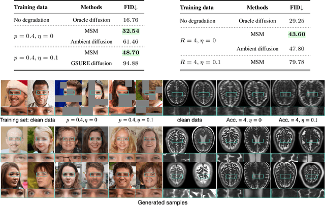 Figure 2 for Measurement Score-Based Diffusion Model