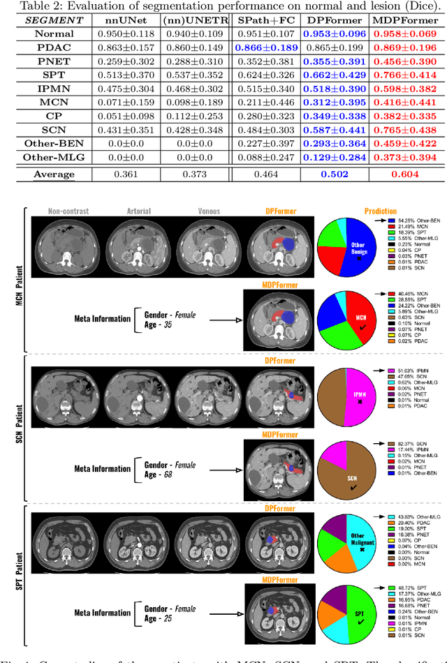 Figure 4 for Meta-information-aware Dual-path Transformer for Differential Diagnosis of Multi-type Pancreatic Lesions in Multi-phase CT