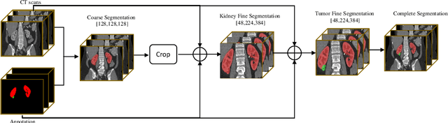 Figure 1 for An Ensemble of 2.5D ResUnet Based Models for Segmentation for Kidney and Masses
