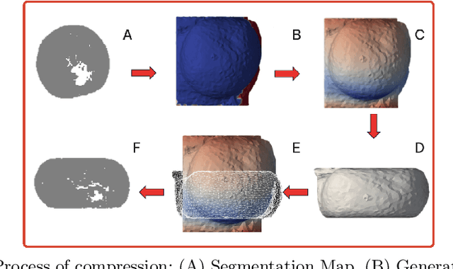 Figure 3 for MRI Breast tissue segmentation using nnU-Net for biomechanical modeling