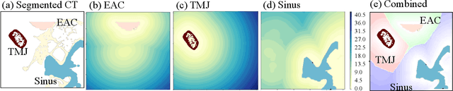 Figure 3 for Improving Surgical Situational Awareness with Signed Distance Field: A Pilot Study in Virtual Reality