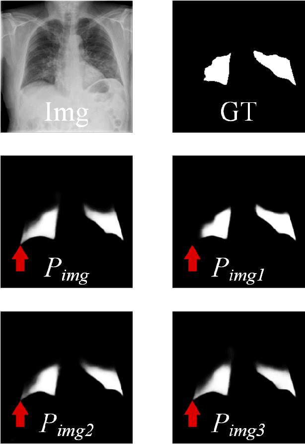 Figure 2 for PCDAL: A Perturbation Consistency-Driven Active Learning Approach for Medical Image Segmentation and Classification