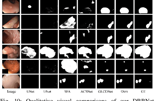 Figure 2 for DRRNet: Macro-Micro Feature Fusion and Dual Reverse Refinement for Camouflaged Object Detection