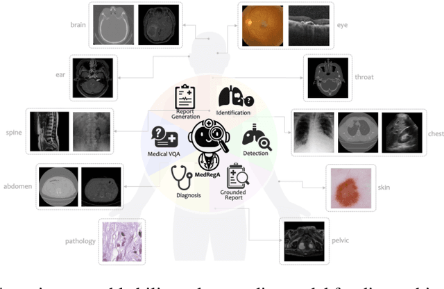 Figure 1 for Interpretable Bilingual Multimodal Large Language Model for Diverse Biomedical Tasks