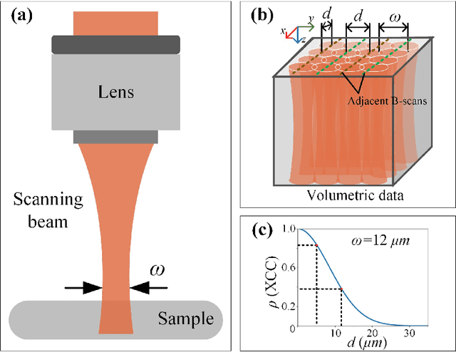 Figure 1 for Toward ground-truth optical coherence tomography via three-dimensional unsupervised deep learning processing and data