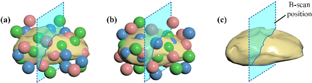 Figure 3 for Toward ground-truth optical coherence tomography via three-dimensional unsupervised deep learning processing and data