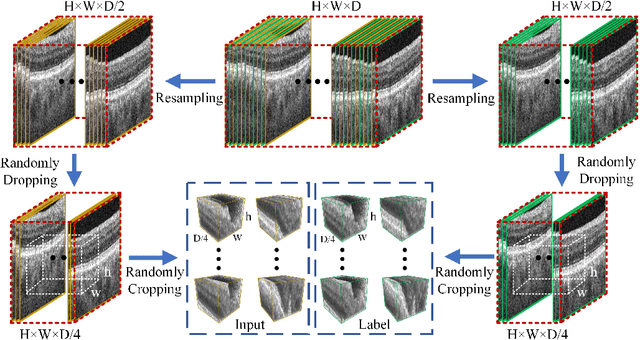 Figure 4 for Toward ground-truth optical coherence tomography via three-dimensional unsupervised deep learning processing and data