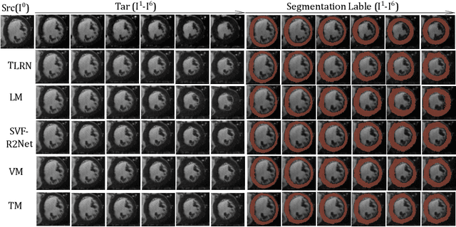Figure 4 for TLRN: Temporal Latent Residual Networks For Large Deformation Image Registration