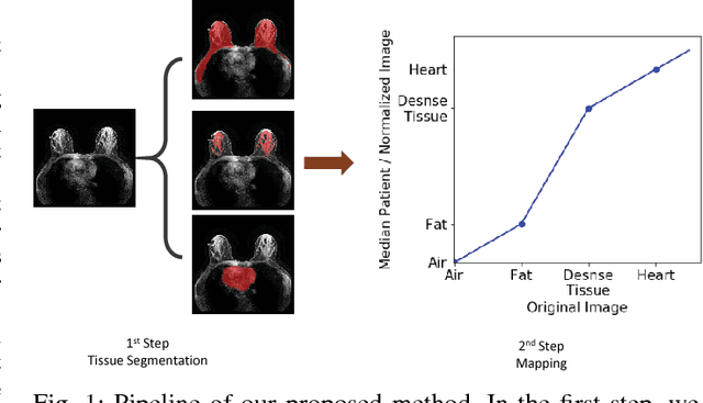 Figure 1 for Automatic deep learning-based normalization of breast dynamic contrast-enhanced magnetic resonance images