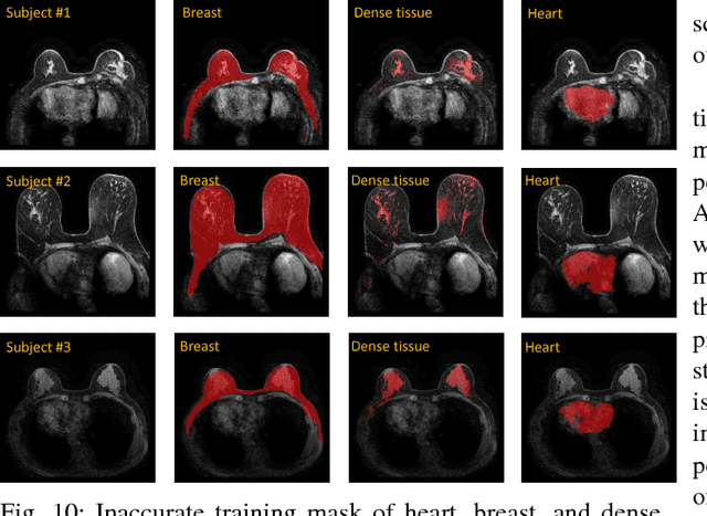 Figure 2 for Automatic deep learning-based normalization of breast dynamic contrast-enhanced magnetic resonance images
