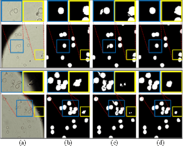 Figure 4 for Image Segmentation and Classification for Sickle Cell Disease using Deformable U-Net