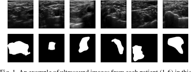 Figure 1 for Automatic Ultrasound Image Segmentation of Supraclavicular Nerve Using Dilated U-Net Deep Learning Architecture