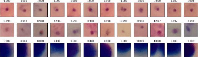 Figure 4 for Deep Convolutional Neural Networks for Microscopy-Based Point of Care Diagnostics