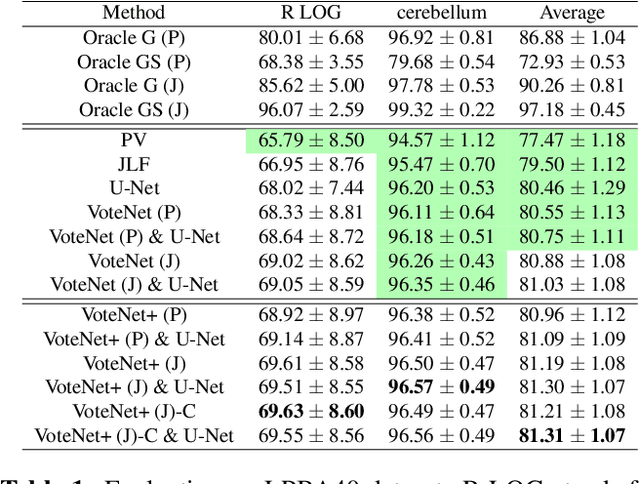 Figure 2 for VoteNet+ : An Improved Deep Learning Label Fusion Method for Multi-atlas Segmentation