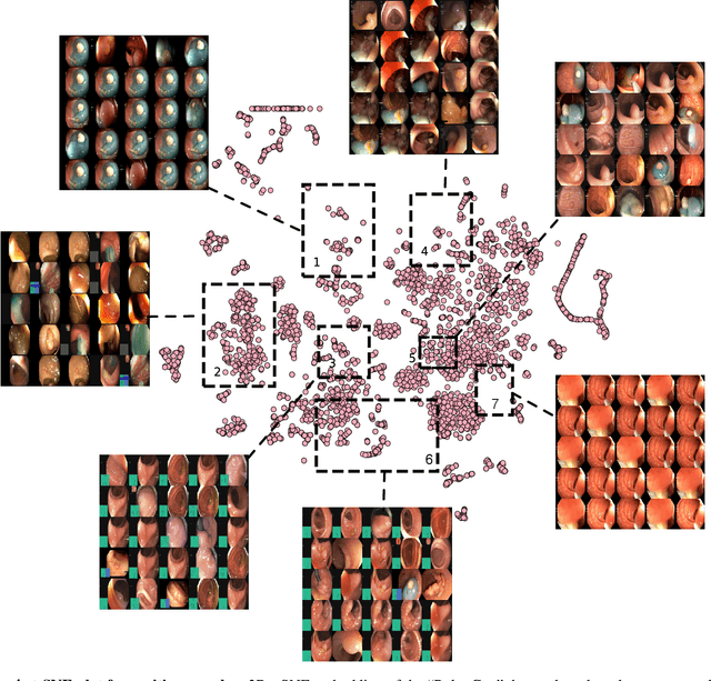 Figure 3 for PolypGen: A multi-center polyp detection and segmentation dataset for generalisability assessment