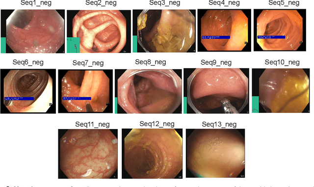 Figure 4 for PolypGen: A multi-center polyp detection and segmentation dataset for generalisability assessment