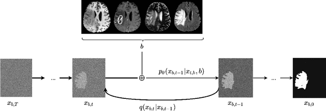 Figure 4 for Diffusion Models for Implicit Image Segmentation Ensembles