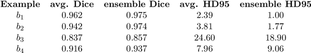 Figure 3 for Diffusion Models for Implicit Image Segmentation Ensembles