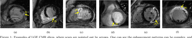 Figure 1 for Cardiac Segmentation on Late Gadolinium Enhancement MRI: A Benchmark Study from Multi-Sequence Cardiac MR Segmentation Challenge