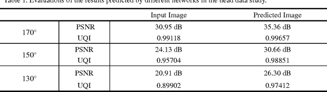 Figure 2 for Image Prediction for Limited-angle Tomography via Deep Learning with Convolutional Neural Network