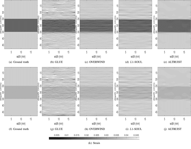 Figure 1 for ALTRUIST: Alternating Direction Method of Multipliers for Total Variation Regularization in Ultrasound Strain Imaging