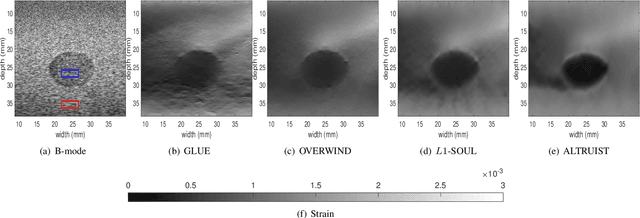 Figure 3 for ALTRUIST: Alternating Direction Method of Multipliers for Total Variation Regularization in Ultrasound Strain Imaging