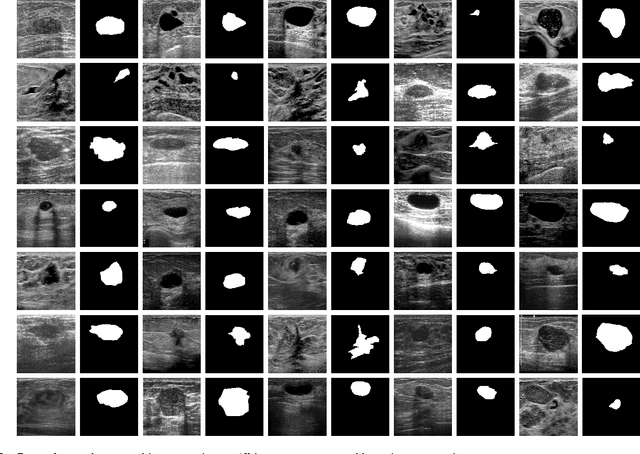 Figure 3 for Self-Configuring and Evolving Fuzzy Image Thresholding