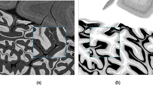 Figure 1 for Confidence-Guided Unsupervised Domain Adaptation for Cerebellum Segmentation