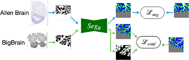 Figure 4 for Confidence-Guided Unsupervised Domain Adaptation for Cerebellum Segmentation