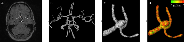 Figure 1 for Future Unruptured Intracranial Aneurysm Growth Prediction using Mesh Convolutional Neural Networks