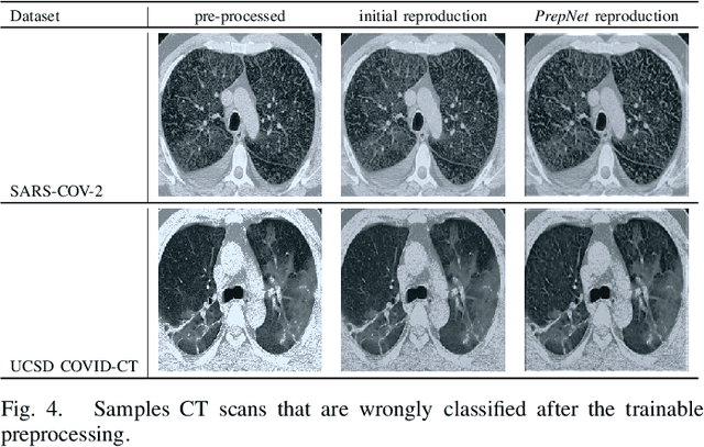 Figure 4 for PrepNet: A Convolutional Auto-Encoder to Homogenize CT Scans for Cross-Dataset Medical Image Analysis