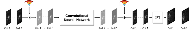 Figure 1 for k-Space Deep Learning for Parallel MRI: Application to Time-Resolved MR Angiography