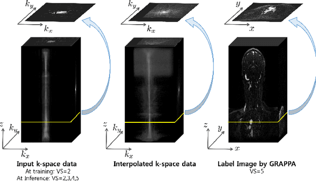 Figure 4 for k-Space Deep Learning for Parallel MRI: Application to Time-Resolved MR Angiography