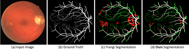 Figure 3 for Self-Supervised Vessel Enhancement Using Flow-Based Consistencies