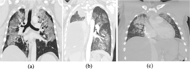 Figure 3 for Diagnosis/Prognosis of COVID-19 Images: Challenges, Opportunities, and Applications