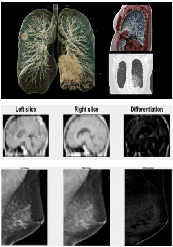 Figure 4 for Diagnosis/Prognosis of COVID-19 Images: Challenges, Opportunities, and Applications