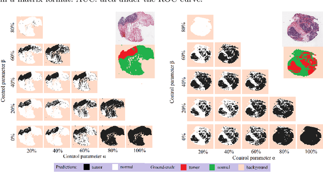 Figure 3 for Weakly supervised multiple instance learning histopathological tumor segmentation