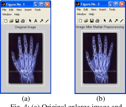 Figure 2 for Shadow Image Enlargement Distortion Removal