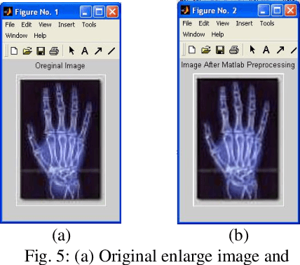 Figure 3 for Shadow Image Enlargement Distortion Removal