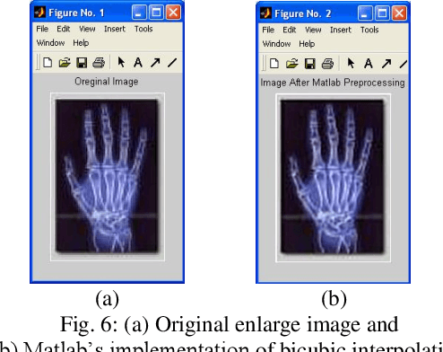 Figure 4 for Shadow Image Enlargement Distortion Removal