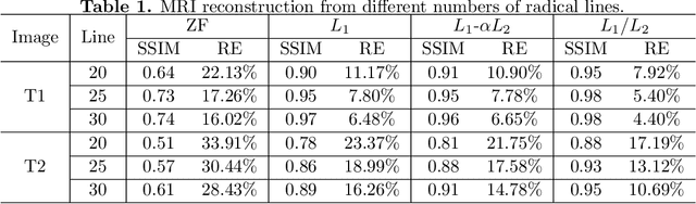 Figure 2 for Minimizing L1 over L2 norms on the gradient