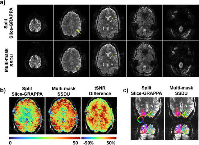 Figure 4 for Unsupervised Deep Learning Methods for Biological Image Reconstruction