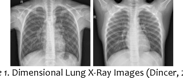 Figure 1 for Applied Computer Vision on 2-Dimensional Lung X-Ray Images for Assisted Medical Diagnosis of Pneumonia