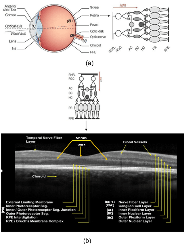 Figure 4 for A Survey on Automated Diagnosis of Alzheimer's Disease Using Optical Coherence Tomography and Angiography