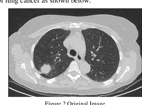 Figure 3 for Reduce Noise in Computed Tomography Image using Adaptive Gaussian Filter