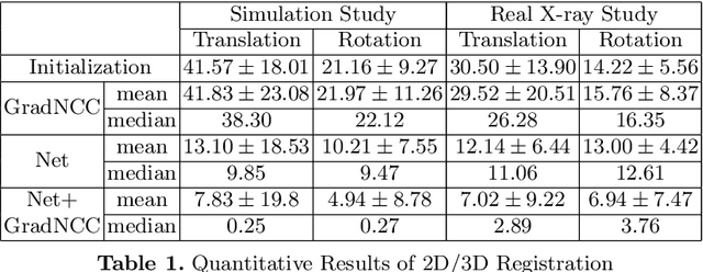 Figure 2 for Generalizing Spatial Transformers to Projective Geometry with Applications to 2D/3D Registration