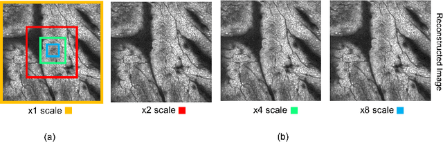 Figure 4 for Can Deep Learning Relax Endomicroscopy Hardware Miniaturization Requirements?