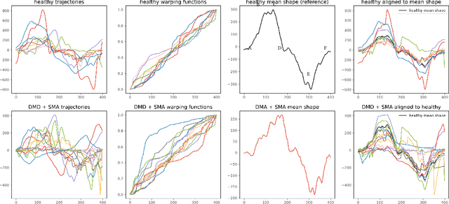 Figure 1 for Shape Analysis for Pediatric Upper Body Motor Function Assessment