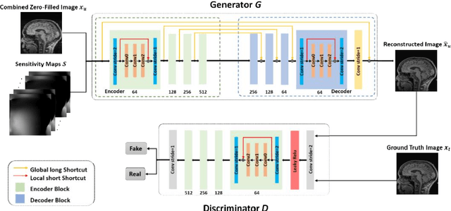 Figure 1 for Transfer Learning Enhanced Generative Adversarial Networks for Multi-Channel MRI Reconstruction