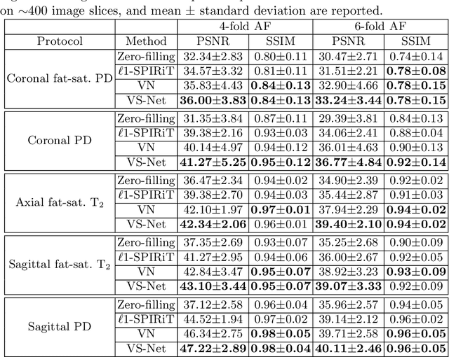 Figure 2 for VS-Net: Variable splitting network for accelerated parallel MRI reconstruction